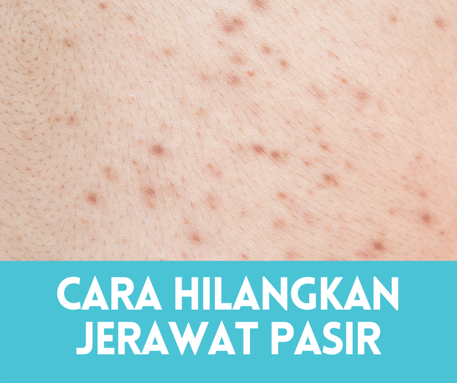 cara hilangkan parut hitam di badan